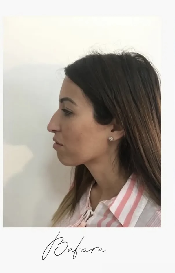 לפני